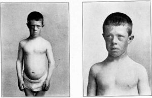 cretinoid-a-cf1561-10246982488503150391048