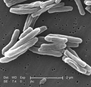 mycobacterium-tuberculosis-4901f6-10249092615512598232096